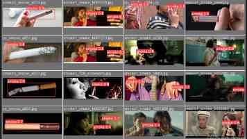 第十七批中国援厄立特里亚医疗队助力受援医院腹腔镜手术破百例